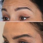 کلینیک پوست مو زیبایی و لیزر آیسل