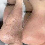 فیشیال / خدمات پوست / سالن زیبایی
