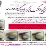 میکروپیگمنتشین قربانی