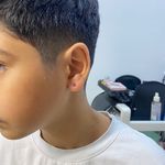 متخصص پیرسینگ،چال لپ،میکرودرمال