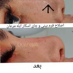 کلینیک پوست و مو و لیزر نیلوفر آبی