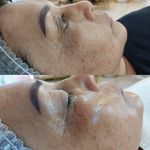 پاکسازی پوست وفیشال تخصصی فاطیما