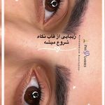اکستنشن مژه لیفت مژه و لیفت ابرو (رُخی)