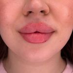 کلینیک زیبایی شایلی