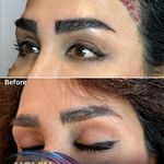 کلینیک پوست مو و زیبایی نوین ایرانا