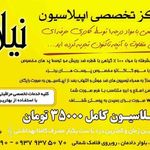 اپیلاسیون نیلا