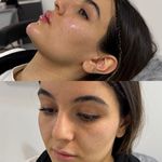 کلینیک پوست مو زیبایی زیما
