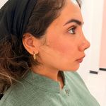 کلینیک پوست مو زیبایی زیما