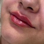 کلینیک پوست مو زیبایی زیما