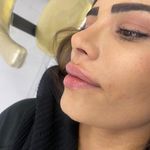 کلینیک پوست مو زیبایی زیما