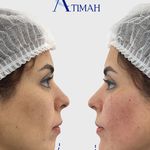 مجموعه زیبایی آتیماه