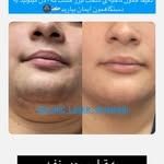 کلینیک زیبایی و لیزر تابان