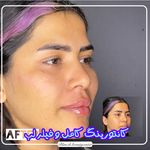 کلینیک پوست و مو بلانژ