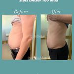 تغذیه و لاغری راز