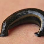 طب سنتی الف