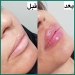 کلینیک پوست،مو،لیزر الیزا