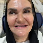 لابراتوار دندانسازی شید
