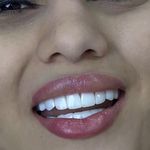 کلینیک‌دندانپزشکی دنتال آرنا-بیمه نیستیم