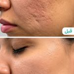 مطب پوست مو لیزر و زیبایی آریاناز