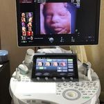 سونوگرافی خورشید پارس