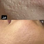 فیشال و خدمات پاکسازی پوست  فاطمه انامی