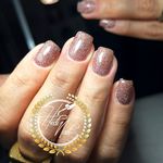 خدمات کاشت و ترمیم ناخن هدیه