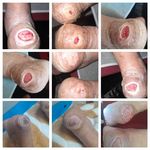 کارشناس زخم و متخصص کیوم تراپی بهرامی فر