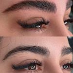 میکروبلیدینگ میناسلمانی