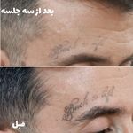 مر کز تخصصی لیزر وکلینیک زیبایی باران