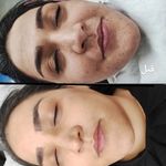 کارشناس پوست و مو الهام لاهشوری
