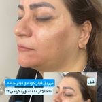 کلینیک زیبایی فریحا(پوست و مو)