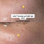 خدمات فیشال تخصصی هدیه جعفرزاده
