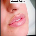 کلینیک پوست و مو و زیبایی روشا