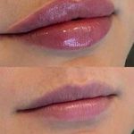 کلینیک زیبایی و پوست و مو رومنس