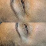 خدمات تخصصی فیشیال لیاناز اسکین هوم