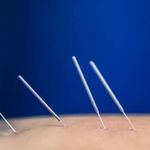 فیزیوتراپی سهروردی دکتر همایون آبایی