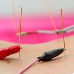 فیزیوتراپی سهروردی دکتر همایون آبایی