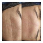 فیشیال و خدمات پوستی برغمدی