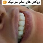 دندانپزشکی ایمپلنت و کلیه خدمات