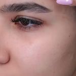 کلینیک زیبایی الماس کاملا اقساطی