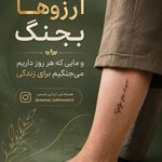 مرکز میکروبلیدینگ شیدینگ ریموو اسکالپ