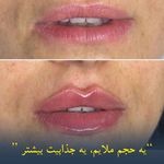 کلینیک پوست وزیبایی ومرکز تخصصی فیلربادی