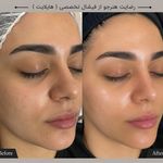 Skincare _eliamini