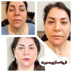 آموزشگاه وخدمات زیبایی تخصصی پوست وموهنرشادی