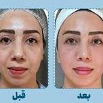 مرکز تخصصی رنگ و لایت اِرنیکا