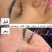 مرکز تخصصی فیشال پوست مائده