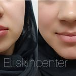 مطب زیبایی دکتر ملکی