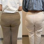 کلینیک لاغری، لیزر، پوست، مو لَوی