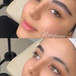 میکروبلیدینگ و شیدینگ مینا حسینی