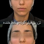 کلینیک پوست مو و لیزر اِلورین